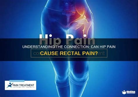 Can Hip Problems Cause Rectal Pain