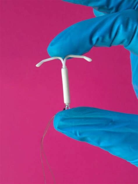 can iud cause nerve pain