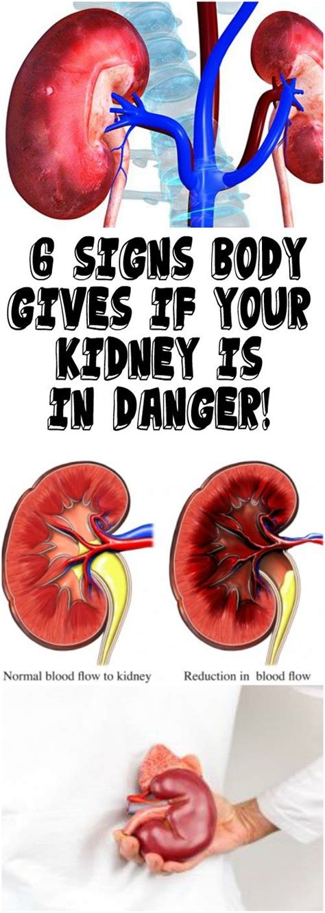 Can Kidneys Dry Up