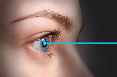 can lasik eye surgery fix astigmatism
