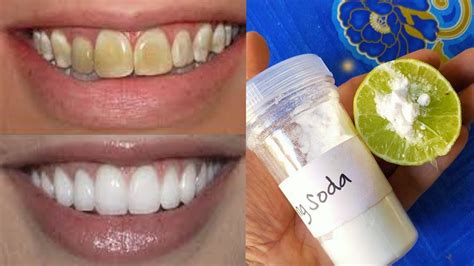 can lemon make your teeth white