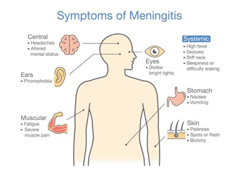 can meningitis symptoms come and go