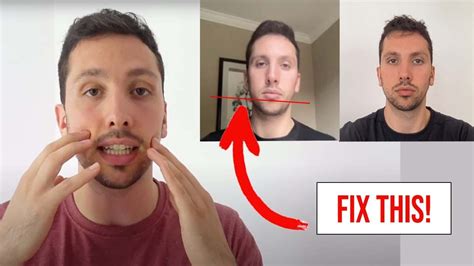 can mewing fix facial asymmetry