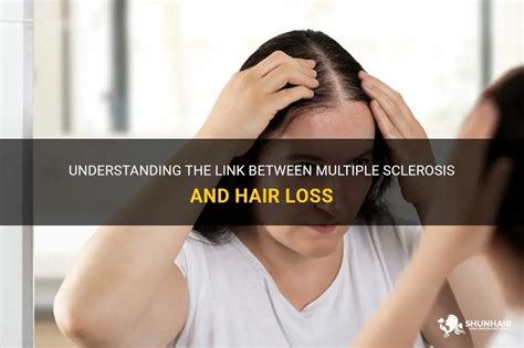 can ms cause hair thinning