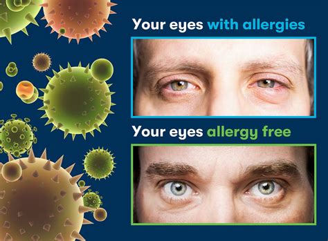 Can New Allergies Develop