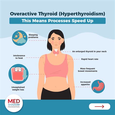 can over exercise cause thyroid problems