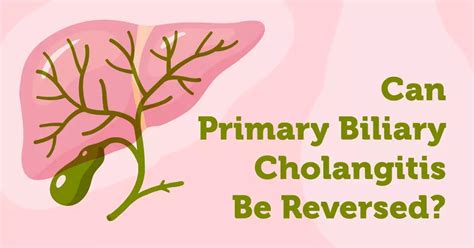 can primary biliary cholangitis be cured