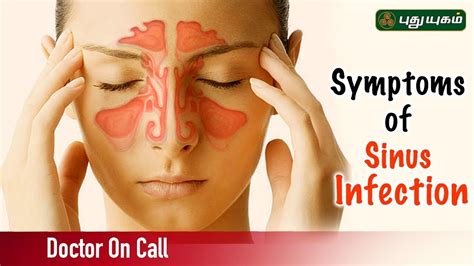 Can Sinus Problems Affect Taste And Smell