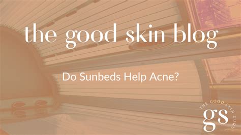 Can Sunbeds Help Back Acne
