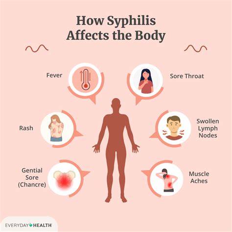 Can Syphilis Spread Through Clothes