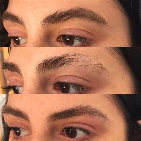 Can T Stop Picking Eyebrows