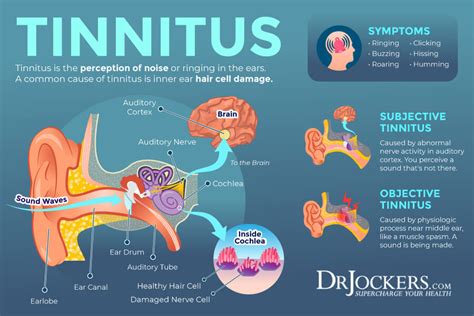Can Teeth Cause Tinnitus