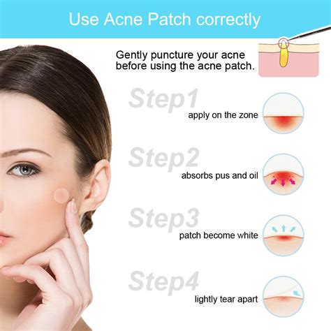 Can The Patch Help With Acne