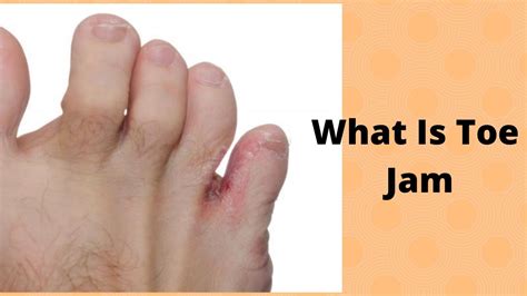 Can U Jam Your Toe
