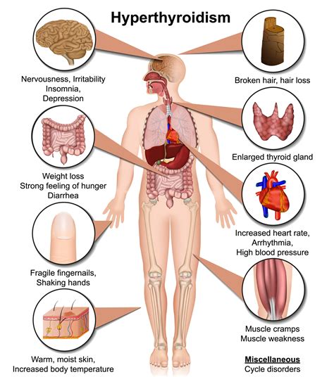 Can Weight Gain Cause Thyroid Issues