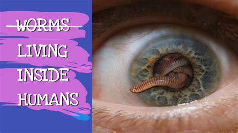 Can Worms Live Inside Humans