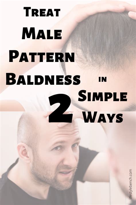 Can Yoga Cure Male Pattern Baldness 