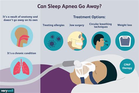 can you cure sleep apnea