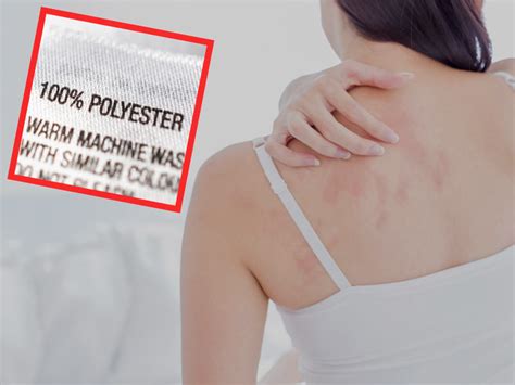 Can You Develop An Allergy To Polyester