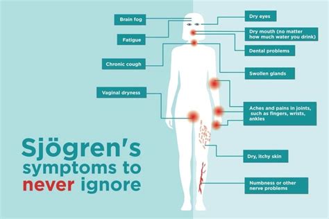 can you die from sjogren's syndrome