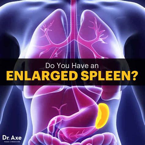 can you feel an enlarged spleen