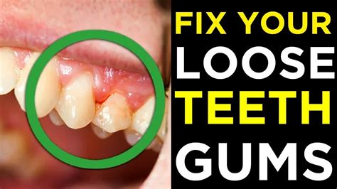 Free Can You Fix A Loose Tooth At Home For Long Hair