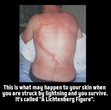 Can You Get Struck By Lightning While You're In The Shower