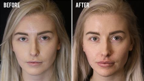 can you reverse facial asymmetry