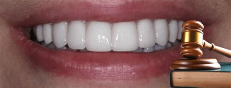 Can You Trust Your Dentist?