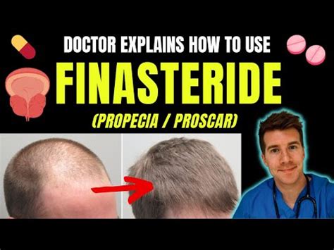 can you take too much finasteride