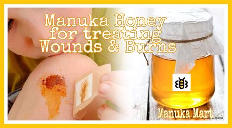can you use manuka honey on open wounds