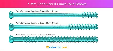cancellous screw vs cannulated screw