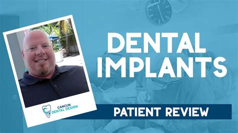 cancun dental implants reviews