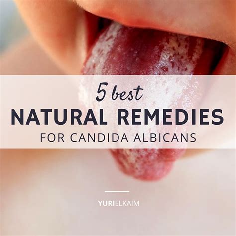 Candida Albicans How To Treat: A Comprehensive Guide