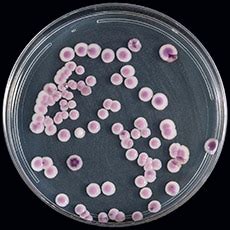 candida auris cdc isolation