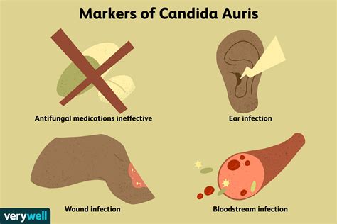 candida auris fungal infection symptoms