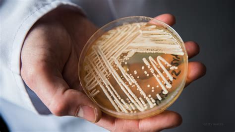 candida auris fungus across the united states