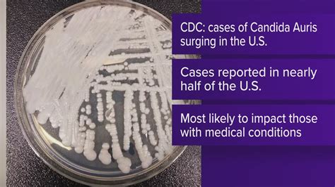 candida auris spreading in us