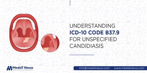 candida icd 10 unspecified