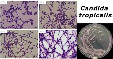 candida tropicalis