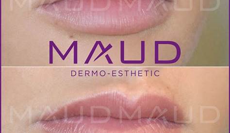 Candy Lips Maud Avant Après Maquillage Permanent Sourcils MAUD