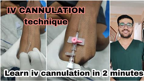 Cannulation Definition Easy