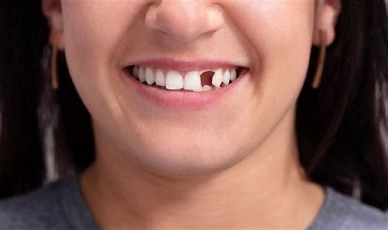 cara agar gigi bisa tumbuh kembali