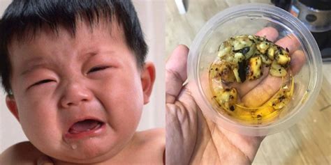 Ubat Batuk Berkahak Untuk Bayi Feed News Indonesia