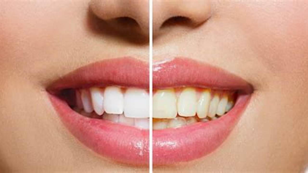 Rahasia Gigi Putih Cemerlang dengan Baking Soda: Temukan Cara Aman dan Efektif