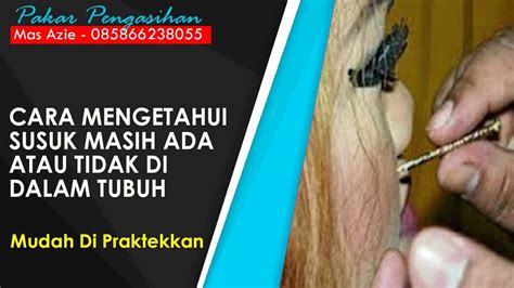 Cara Mengetahui Susuk Masih Ada Atau Tidak