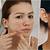 cara menghilangkan kemerahan di wajah akibat jerawat