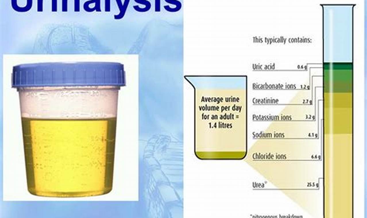 cara menghitung sedimen urine