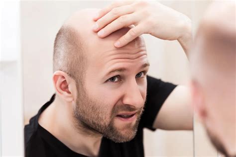 Rahasia Rambut Tebal: Cara Cepat Menumbuhkan Rambut Botak dalam 1 Minggu