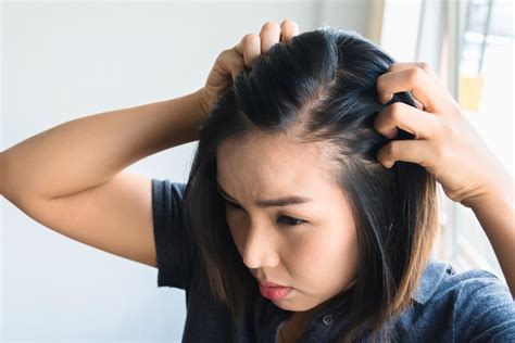 Cara Membuat Rambut Tidak Lepek: Tips Praktis untuk Rambut Bebas Minyak